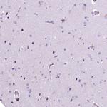 RDH16 Antibody in Immunohistochemistry (IHC)