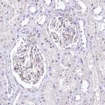 RDH16 Antibody in Immunohistochemistry (IHC)