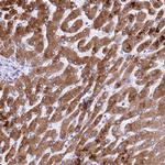 RDH16 Antibody in Immunohistochemistry (IHC)