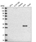 RDH16 Antibody in Western Blot (WB)