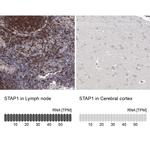 STAP1 Antibody