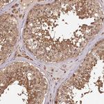 TTC12 Antibody in Immunohistochemistry (IHC)