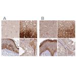 HAL Antibody in Immunohistochemistry (IHC)