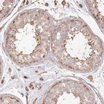 HAL Antibody in Immunohistochemistry (IHC)