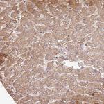 HAL Antibody in Immunohistochemistry (IHC)