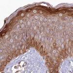 HAL Antibody in Immunohistochemistry (IHC)