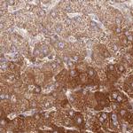 HAL Antibody in Immunohistochemistry (IHC)