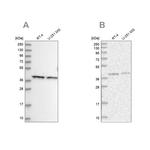 PSMD13 Antibody in Western Blot (WB)