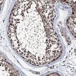 PSMD13 Antibody in Immunohistochemistry (IHC)