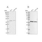 PSMD13 Antibody in Western Blot (WB)