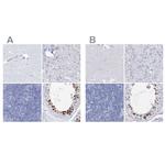 Acrosomal Vesicle Protein Antibody in Immunohistochemistry (IHC)