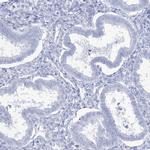 Acrosomal Vesicle Protein Antibody in Immunohistochemistry (IHC)