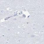 Acrosomal Vesicle Protein Antibody in Immunohistochemistry (IHC)