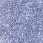 Acrosomal Vesicle Protein Antibody in Immunohistochemistry (IHC)