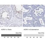 Acrosomal Vesicle Protein Antibody in Immunohistochemistry (IHC)