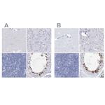 Acrosomal Vesicle Protein Antibody in Immunohistochemistry (IHC)