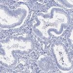 Acrosomal Vesicle Protein Antibody in Immunohistochemistry (IHC)