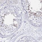 Acrosomal Vesicle Protein Antibody in Immunohistochemistry (IHC)