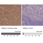 CD99L2 Antibody in Immunohistochemistry (IHC)