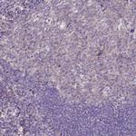 CD99L2 Antibody in Immunohistochemistry (IHC)