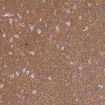 CD99L2 Antibody in Immunohistochemistry (IHC)