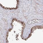 RRP9 Antibody in Immunohistochemistry (IHC)