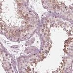 KIF6 Antibody in Immunohistochemistry (IHC)