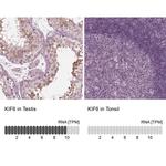 KIF6 Antibody