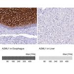 A2ML1 Antibody in Immunohistochemistry (IHC)