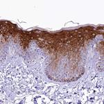 A2ML1 Antibody in Immunohistochemistry (IHC)