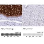 A2ML1 Antibody in Immunohistochemistry (IHC)