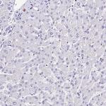 A2ML1 Antibody in Immunohistochemistry (IHC)