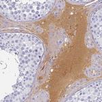 CFHR1 Antibody in Immunohistochemistry (IHC)