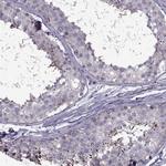 ODF3 Antibody in Immunohistochemistry (IHC)