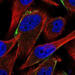 CFHR1 Antibody in Immunocytochemistry (ICC/IF)