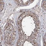 PTDSS2 Antibody in Immunohistochemistry (IHC)