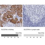 SLC37A4 Antibody