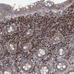 SAAL1 Antibody in Immunohistochemistry (IHC)