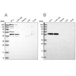 SAAL1 Antibody in Western Blot (WB)