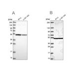 Importin 4 Antibody in Western Blot (WB)