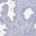 C11orf66 Antibody in Immunohistochemistry (IHC)