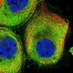 GADL1 Antibody in Immunocytochemistry (ICC/IF)