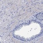 MYOZ3 Antibody in Immunohistochemistry (IHC)