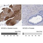 MYOZ3 Antibody