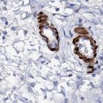 NRIP2 Antibody in Immunohistochemistry (IHC)