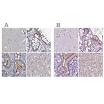 ACY3 Antibody in Immunohistochemistry (IHC)