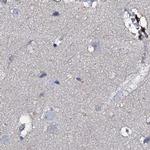 ACY3 Antibody in Immunohistochemistry (IHC)