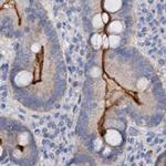 ACY3 Antibody in Immunohistochemistry (IHC)