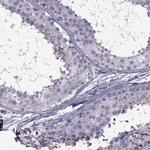 ODF3 Antibody in Immunohistochemistry (IHC)