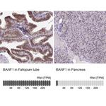 BANF1 Antibody in Immunohistochemistry (IHC)